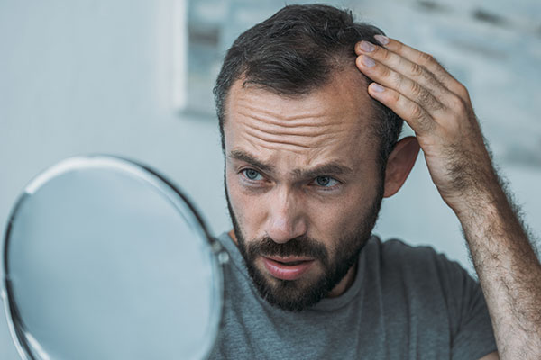 Debunking Myths About Baldness: Separating Facts from Fiction